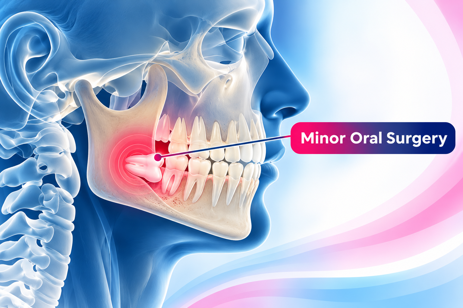 Minor Oral Surgical Procedures